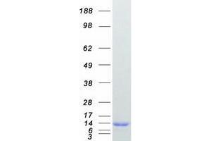 Western Blotting (WB) image for Cystatin A (Stefin A) (CSTA) protein (Myc-DYKDDDDK Tag) (ABIN2712791)