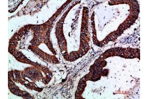 Immunohistochemistry (IHC) image for anti-Gremlin 2 (GREM2) (AA 71-120) antibody (ABIN7189526)