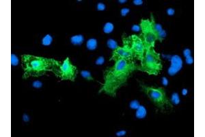 Anti-SCHIP1 mouse monoclonal antibody (ABIN2455665) immunofluorescent staining of COS7 cells transiently transfected by pCMV6-ENTRY SCHIP1 (RC206269). (SCHIP1 抗体)