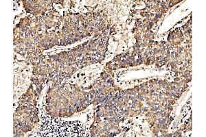 IHC analysis of HIP1R using anti-HIP1R antibody (ABIN7601290). (HIP1R 抗体  (AA 316-734))
