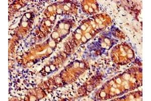 Immunohistochemistry (IHC) image for anti-Solute Carrier Family 5 (Sodium/glucose Cotransporter), Member 1 (SLC5A1) (AA 564-643) antibody (ABIN7170011)