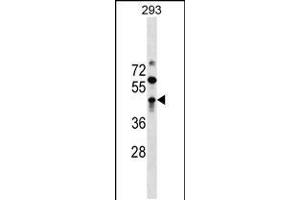 Western Blotting (WB) image for anti-Zinc Finger and BTB Domain Containing 32 (ZBTB32) (AA 96-125), (N-Term) antibody (ABIN5532282)