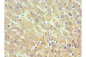 Immunohistochemistry of paraffin-embedded human liver tissue using ABIN7173812 at dilution of 1:100 (TNFSF18 抗体  (AA 72-199))
