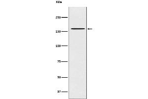 Western blot analysis of CLASP1 expression in HeLa cell lysate.