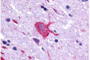 Immunohistochemical (Formalin/PFA-fixed paraffin-embedded sections) staining in human brain, neurons and glia with LGR4 polyclonal antibody . (LGR4 抗体  (C-Term))