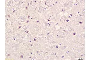 Formalin-fixed and paraffin embedded mouse brain labeled with Anti-PLAUR Polyclonal Antibody, Unconjugated  at 1:200 followed by conjugation to the secondary antibody and DAB staining. (PLAUR 抗体  (AA 201-300))