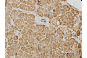 Immunoperoxidase of monoclonal antibody to PDK2 on formalin-fixed paraffin-embedded human pancreas. (PDK2 抗体  (AA 187-276))
