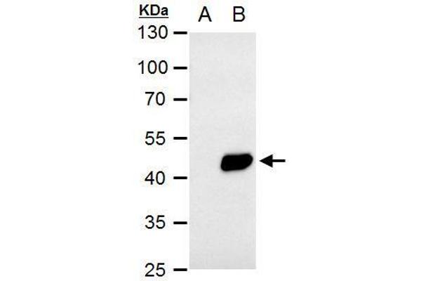 PDK1 抗体