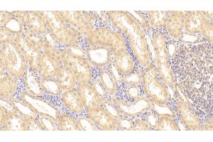 Detection of TMPRSS2 in Porcine Kidney Tissue using Polyclonal Antibody to Transmembrane Protease, Serine 2 (TMPRSS2) (TMPRSS2 抗体  (AA 284-492))