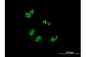 Immunofluorescence of monoclonal antibody to TCOF1 on HeLa cell. (TCOF1 抗体  (AA 2-82))