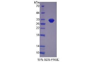 Image no. 1 for Lactamase, beta (LACTB) (AA 313-547) protein (His tag) (ABIN6237257)