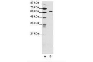 Image no. 1 for anti-SMAD, Mothers Against DPP Homolog 1 (SMAD1) (C-Term) antibody (ABIN202590) (SMAD1 抗体  (C-Term))