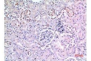 Immunohistochemistry (IHC) analysis of paraffin-embedded Human Kidney, antibody was diluted at 1:100. (XRCC6 抗体  (Ser402))