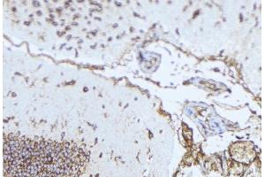 ABIN6276984 at 1/100 staining Mouse brain tissue by IHC-P. (Norrie Disease (Pseudoglioma) 抗体)