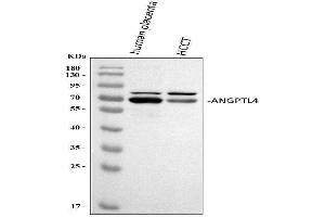 Western blot analysis of ANGPTL4 using anti-ANGPTL4 antibody (ABIN5518734). (ANGPTL4 抗体  (C-Term))