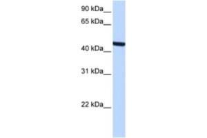 Western Blotting (WB) image for anti-Zinc Finger, C3HC-Type Containing 3 (ZCCHC3) antibody (ABIN2463365) (ZCCHC3 抗体)