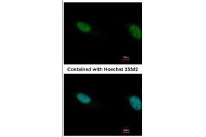 ICC/IF Image Immunofluorescence analysis of paraformaldehyde-fixed HeLa, using PB1, antibody at 1:500 dilution. (Polybromo 1 抗体  (N-Term))