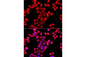 Immunofluorescence analysis of A549 cell using OSGEPL1 antibody. (OSGEPL1 抗体)