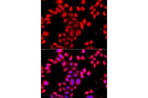 Immunofluorescence analysis of A549 cell using OSGEPL1 antibody. (OSGEPL1 抗体)