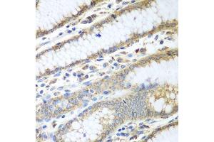 Immunohistochemistry of paraffin-embedded human stomach using PDIA3 antibody. (PDIA3 抗体  (AA 206-505))