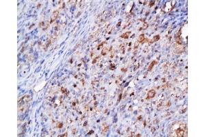 Immunohistochemistry (Paraffin-embedded Sections) (IHC (p)) image for anti-Cyclin-Dependent Kinase 2 (CDK2) (AA 1-100) antibody (ABIN2172819) (CDK2 抗体  (AA 1-100))