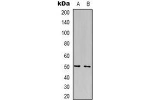 Western blot analysis of FOXN4 expression in Jurkat (A), HepG2 (B) whole cell lysates. (FOXN4 抗体  (C-Term))