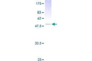 TWSG1 Protein (AA 1-223) (GST tag)