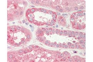 Human Kidney: Formalin-Fixed, Paraffin-Embedded (FFPE) (Stim2 抗体  (N-Term))