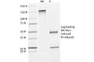 SDS-PAGE Analysis Purified Cytokeratin 8 Mouse Monoclonal Antibody (C-43). (KRT8 抗体)