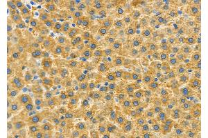 ABIN6262577 and ABIN6279542 at 1/100 staining Rat liver tissue by IHC-P.