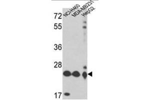 Western blot analysis of PRDX3 Antibody (Peroxiredoxin 3 抗体  (N-Term))
