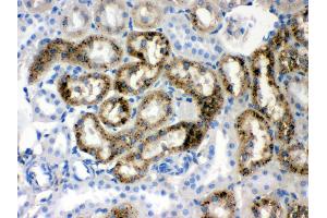Anti- Prealbumin Picoband antibody,IHC(P) IHC(P): Rat Kidney Tissue (TTR 抗体  (AA 21-147))