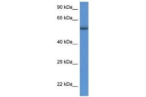 Human MDA-MB435; WB Suggested Anti-GBA Antibody Titration: 1 ug/ml. (GBA 抗体  (C-Term))