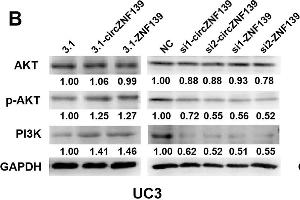 ZNF139 and its circRNA (circZNF139) activates PI3K/AKT signaling pathway in BC cells. (GAPDH 抗体)