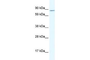 WB Suggested Anti-AHR Antibody Titration:  2. (Aryl Hydrocarbon Receptor 抗体  (N-Term))