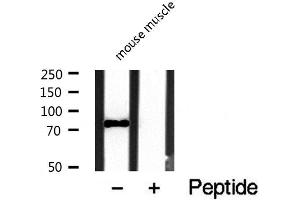 Western blot analysis of PDE4C expression in mouse brain lysate (PDE4C 抗体  (Internal Region))
