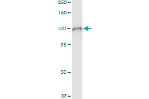 Immunoprecipitation (IP) image for anti-Signal Transducer and Activator of Transcription 1, 91kDa (STAT1) (AA 1-712) antibody (ABIN950042)