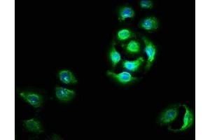 Immunofluorescence staining of A549 cells with ABIN7162334 at 1:100, counter-stained with DAPI. (OTUD5 抗体  (AA 51-183))