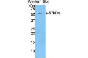 Western blot analysis of the recombinant protein. (N-Acetyl alpha-D-Glucosaminidase (AA 449-709) 抗体)