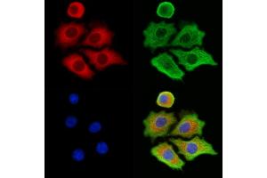 ABIN6263420 and ABIN6273269 staining HepG2 cells by IF/ICC. (MTHFD1L 抗体  (C-Term))