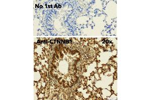 Immunohistochemistry (IHC) image for anti-Catenin, beta (CATNB) (C-Term) antibody (ABIN6254224)