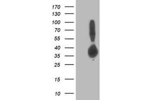 Western Blotting (WB) image for anti-Aldolase B, Fructose-Bisphosphate (ALDOB) antibody (ABIN1496608) (ALDOB 抗体)