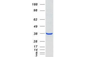 Western Blotting (WB) image for Heme Oxygenase (Decycling) 2 (HMOX2) (Transcript Variant 3) protein (Myc-DYKDDDDK Tag) (ABIN2722596)