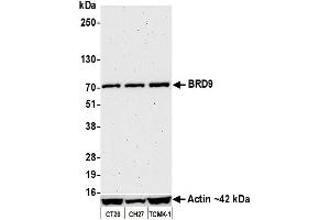 Western Blotting (WB) image for anti-Bromodomain Containing 9 (BRD9) (AA 547-597) antibody (ABIN7455162)