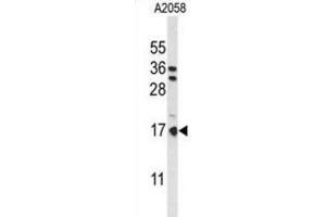 Western Blotting (WB) image for anti-Parathymosin (PTMS) antibody (ABIN3004110) (Parathymosin 抗体)
