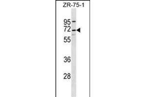 C10orf2 Antibody (C-term) (ABIN656726 and ABIN2845951) western blot analysis in ZR-75-1 cell line lysates (35 μg/lane).