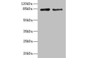 Western blot All lanes: HJURP antibody at 12 μg/mL Lane 1: Jurkat whole cell lysate Lane 2: Hela whole cell lysate Secondary Goat polyclonal to rabbit IgG at 1/10000 dilution Predicted band size: 84, 78, 75 kDa Observed band size: 84 kDa (HJURP 抗体  (AA 1-748))