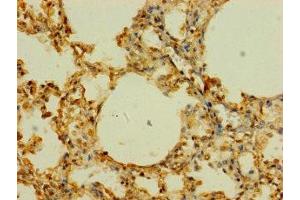 Immunohistochemistry of paraffin-embedded human lung tissue using ABIN7170255 at dilution of 1:100 (SLC43A3 抗体  (AA 209-278))
