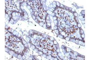 Immunohistochemistry (IHC) image for anti-Spleen Focus Forming Virus (SFFV) Proviral Integration Oncogene Spi1 (SPI1) (AA 16-170) antibody (ABIN6940631)