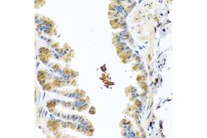 Immunohistochemistry of paraffin-embedded mouse lung using CHI3L2 antibody at dilution of 1:100 (40x lens). (CHI3L2 抗体)